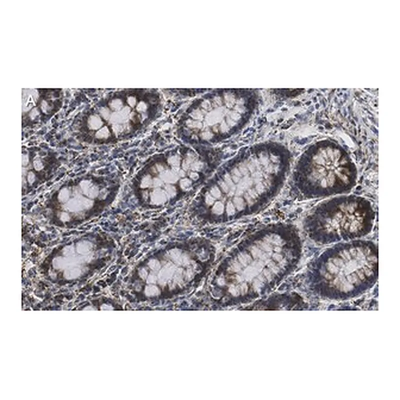 Merck Anti-Mn-SOD Antibody, clone 1C14 ZooMAb Rabbit Monoclonal
