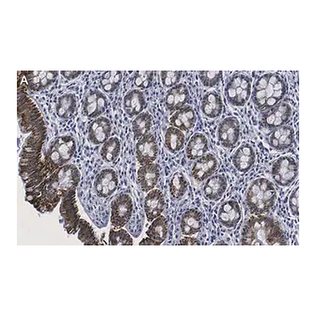 Merck Anti-Tubulin γ-2 Antibody, clone 1M19 ZooMAb Rabbit Monoclonal