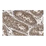 Merck Anti-KLF5 Antibody, clone 1J12 ZooMAb Rabbit Monoclonal