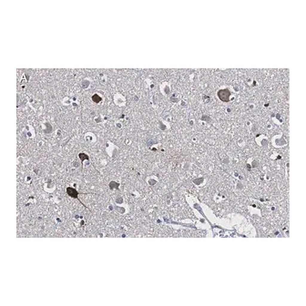 Merck Anti-Prion Protein Antibody, clone 3D17 ZooMAb Rabbit Monoclonal