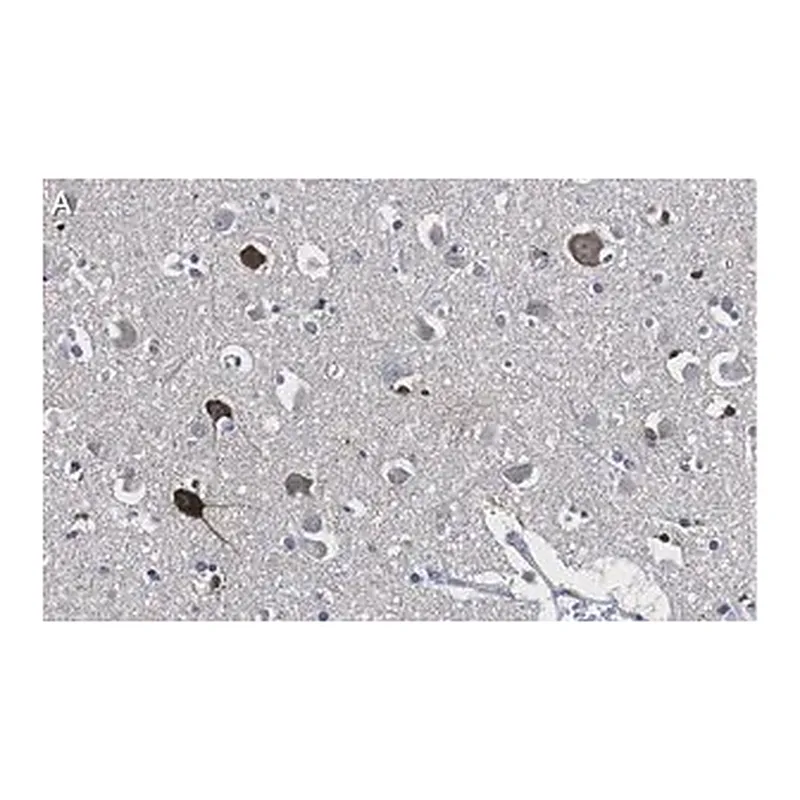 Merck Anti-Prion Protein Antibody, clone 3D17 ZooMAb Rabbit Monoclonal