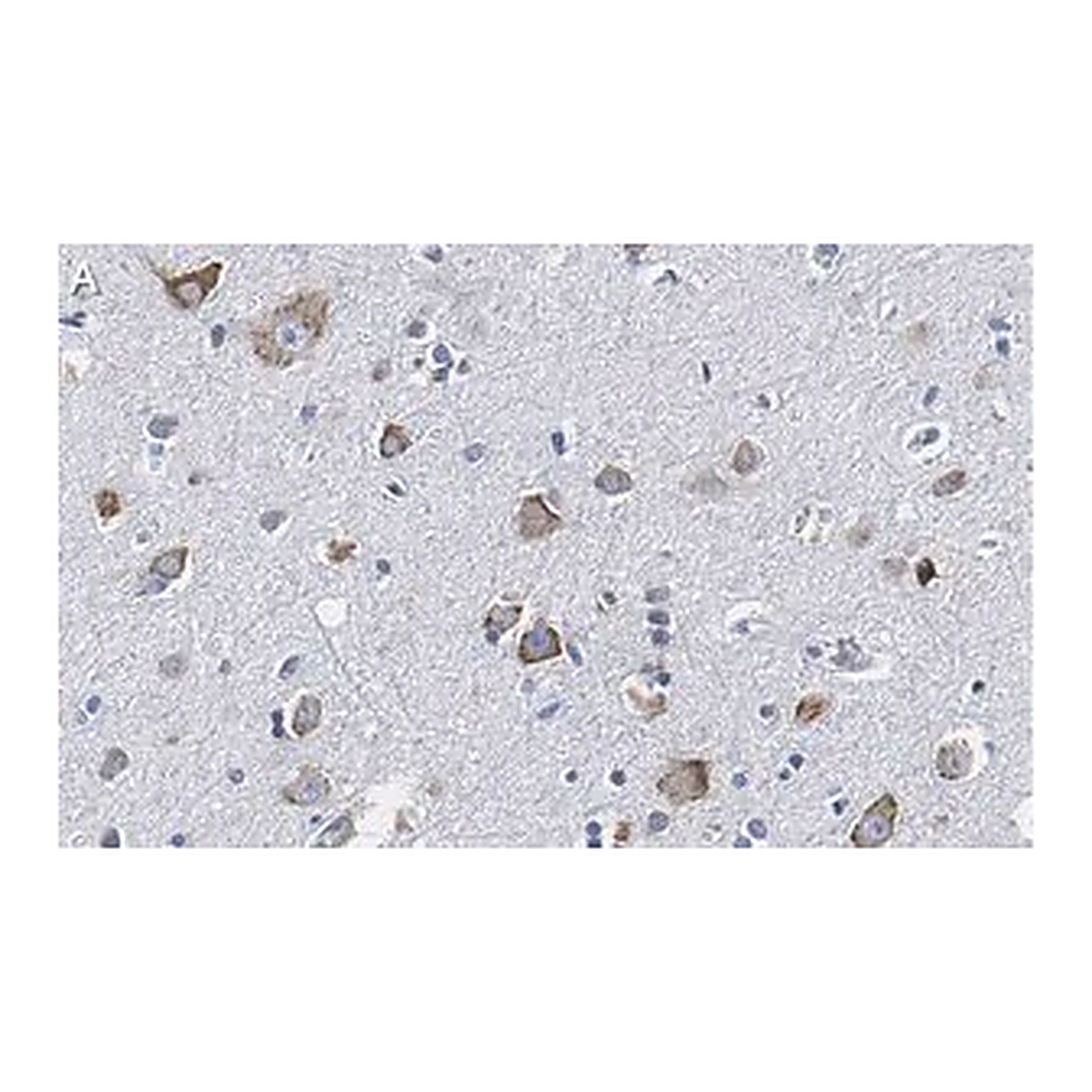 Merck Anti-CGRP-1 Antibody, clone 2E18 ZooMAb Rabbit Monoclonal
