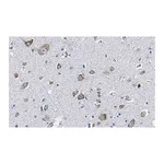 Merck Anti-CGRP-1 Antibody, clone 2E18 ZooMAb Rabbit Monoclonal
