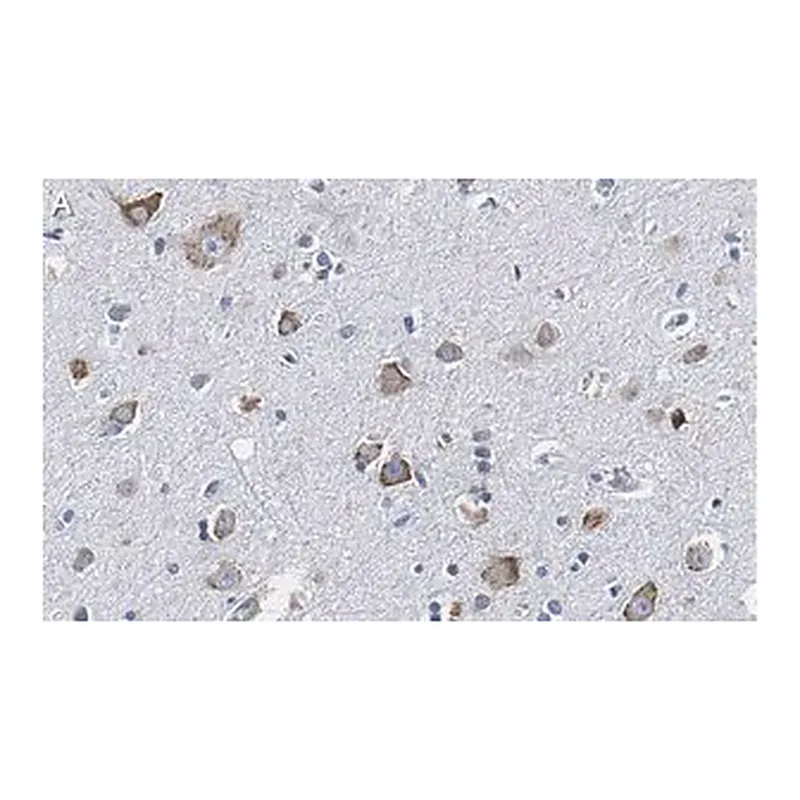 Merck Anti-CGRP-1 Antibody, clone 2E18 ZooMAb Rabbit Monoclonal