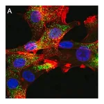 Merck Anti-FGFR1 Antibody, clone 2J21 ZooMAb Rabbit Monoclonal