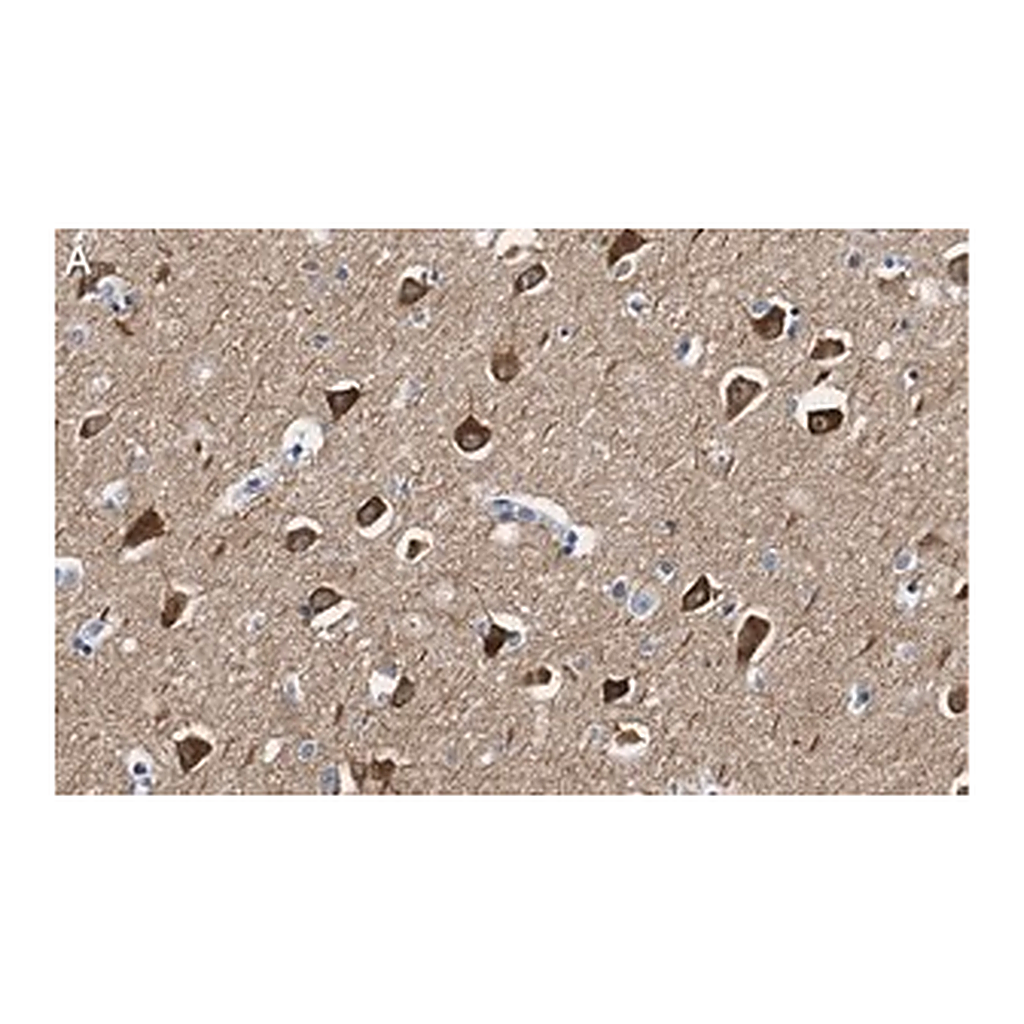 Merck Anti-CaM Kinase IIα Antibody, clone 1C20 ZooMAb Rabbit Monoclonal