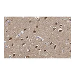 Merck Anti-CaM Kinase IIα Antibody, clone 1C20 ZooMAb Rabbit Monoclonal
