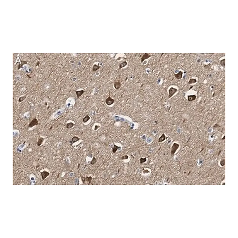 Merck Anti-CaM Kinase IIα Antibody, clone 1C20 ZooMAb Rabbit Monoclonal