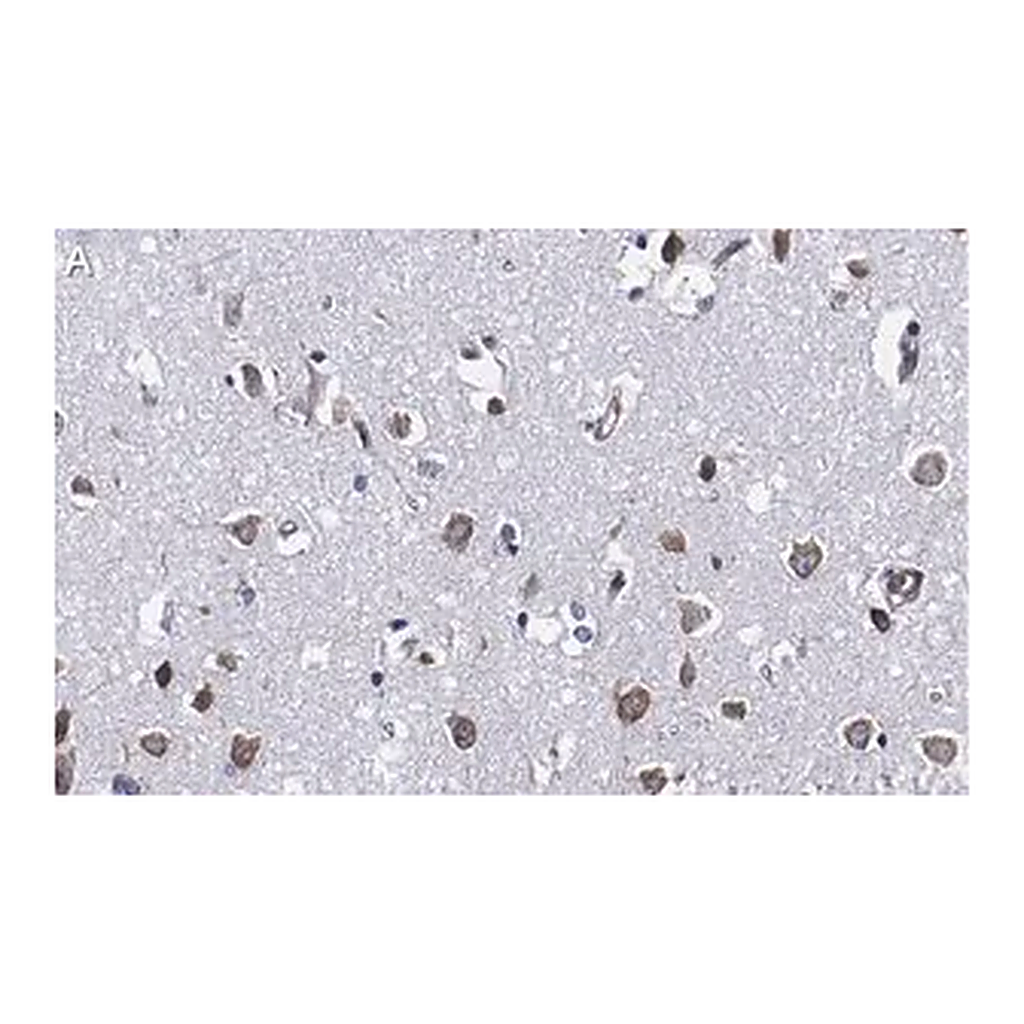 Merck Anti-Ago2 Antibody, clone 2H10 ZooMAb Rabbit Monoclonal