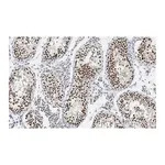 Merck Anti-HDAC2 Antibody, clone 1E22 ZooMAb Rabbit Monoclonal