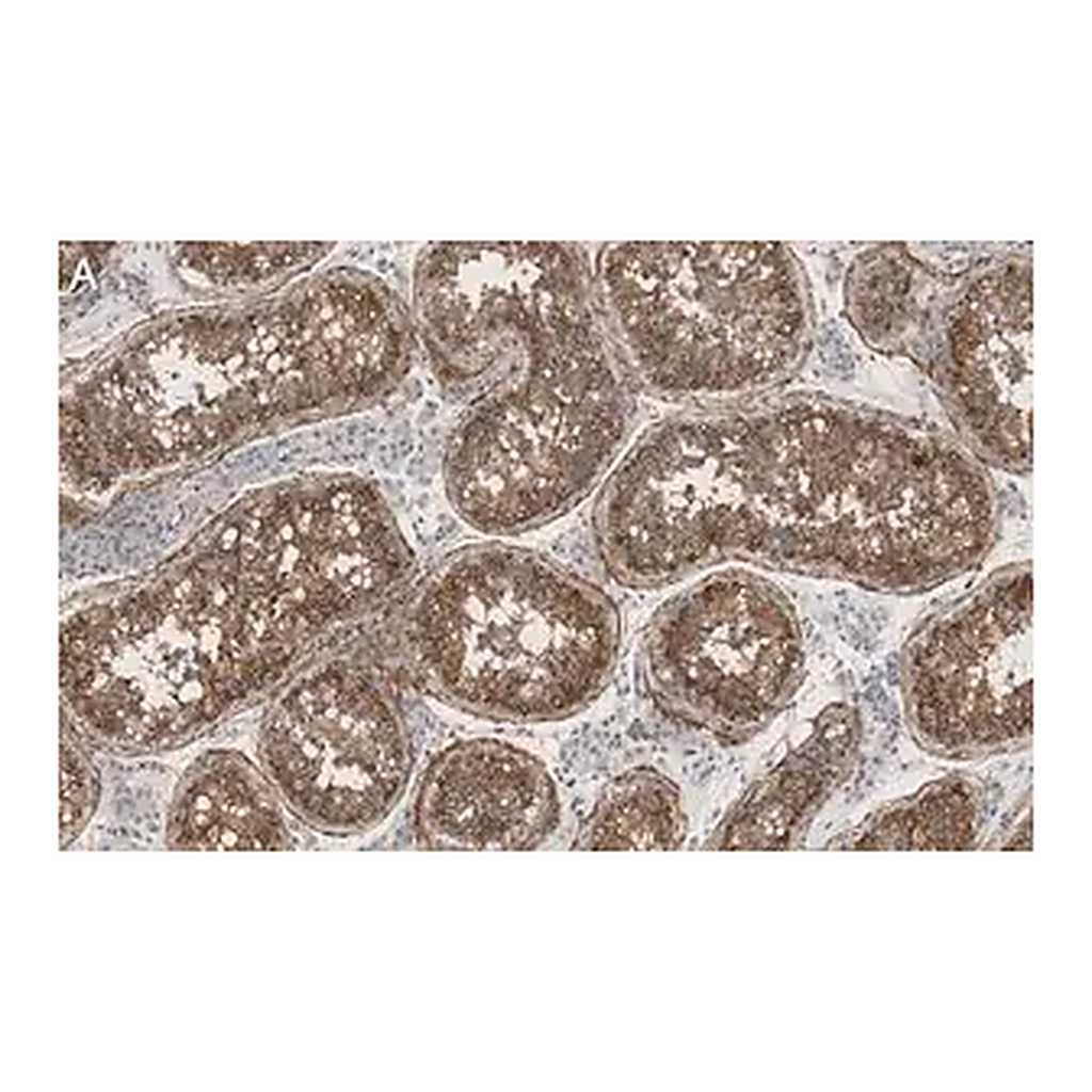Merck Anti-Nectin-2/CD112 Antibody, clone 2H6 ZooMAb Rabbit Monoclonal