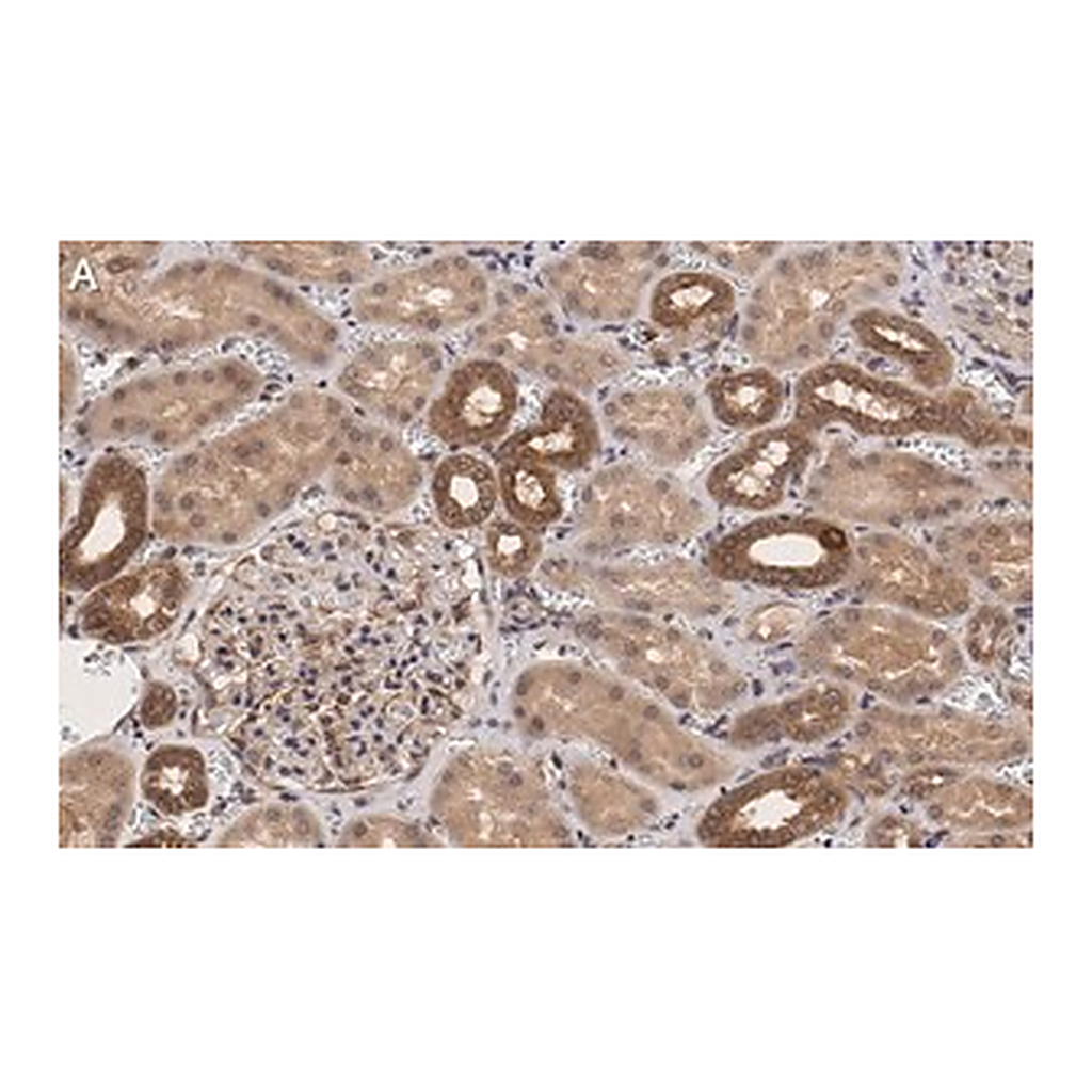 Merck Anti-TSC2 Antibody, clone 4H10 ZooMAb Rabbit Monoclonal
