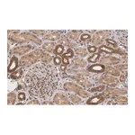 Merck Anti-TSC2 Antibody, clone 4H10 ZooMAb Rabbit Monoclonal