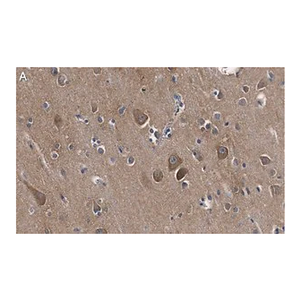 Merck Anti-Catenin-α 2 Antibody, clone 3F7 ZooMAb Rabbit Monoclonal