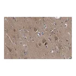 Merck Anti-Catenin-α 2 Antibody, clone 3F7 ZooMAb Rabbit Monoclonal