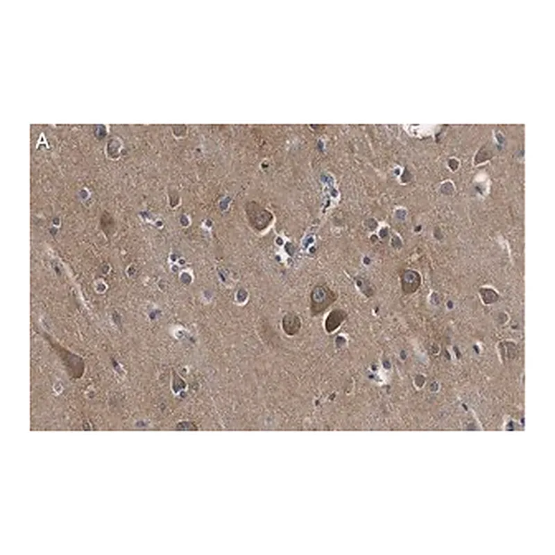 Merck Anti-Catenin-α 2 Antibody, clone 3F7 ZooMAb Rabbit Monoclonal