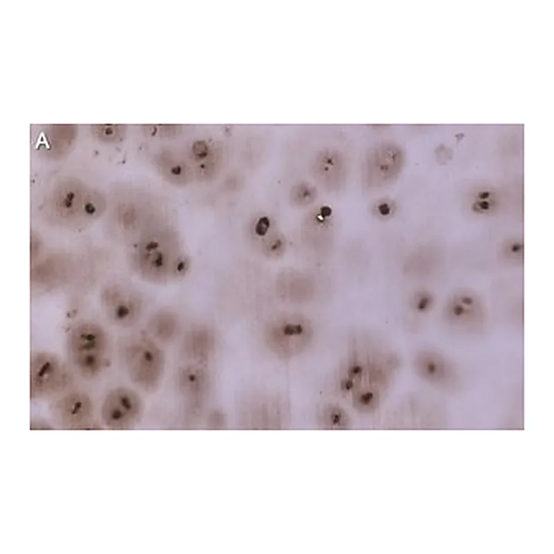 Merck Anti-Aggrecan Antibody, clone 4B10 ZooMAb Rabbit Monoclonal