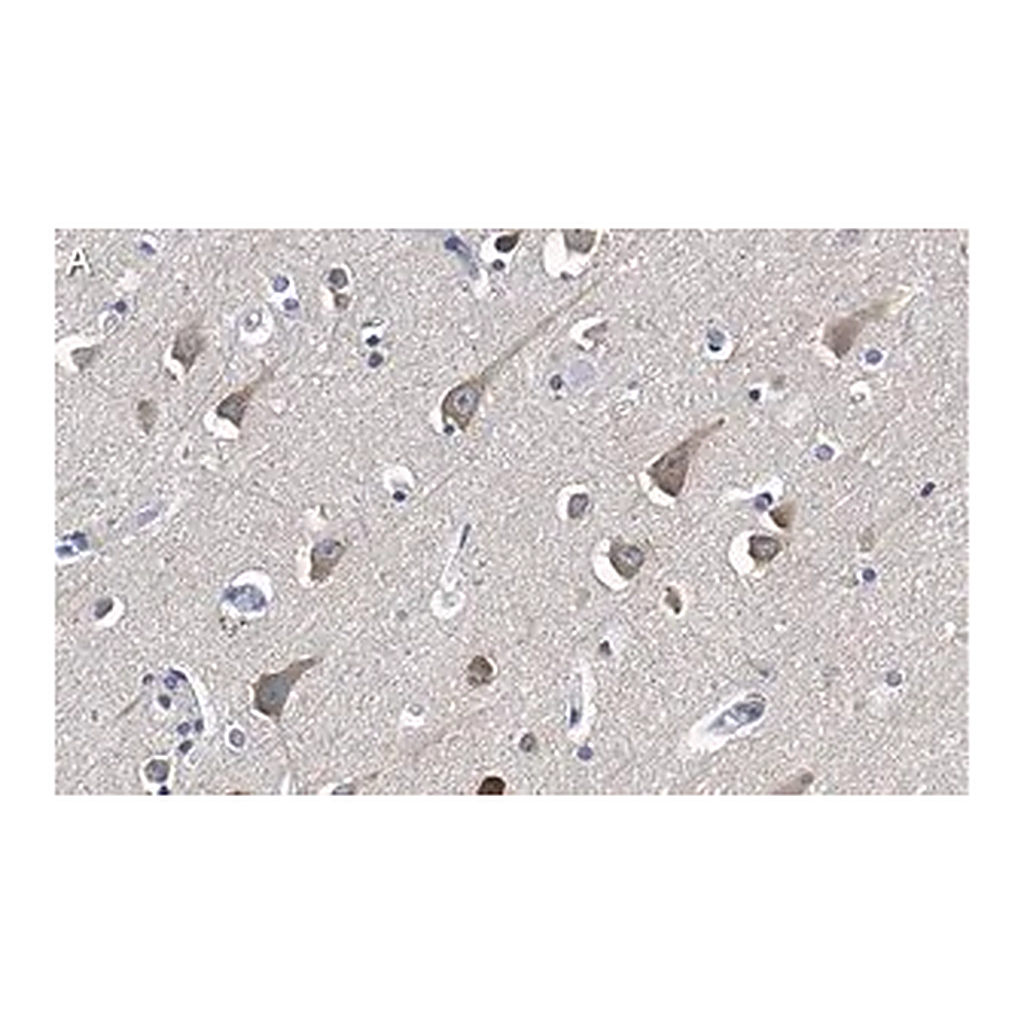 Merck Anti-LC3A Antibody, clone 3J12 ZooMAb Rabbit Monoclonal