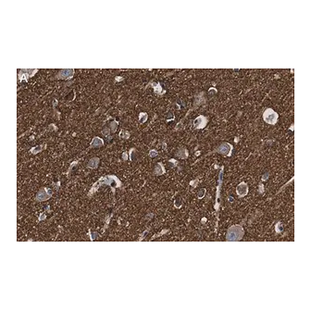 Merck Anti-α-synuclein Antibody, clone 1D22 ZooMAb Rabbit Monoclonal