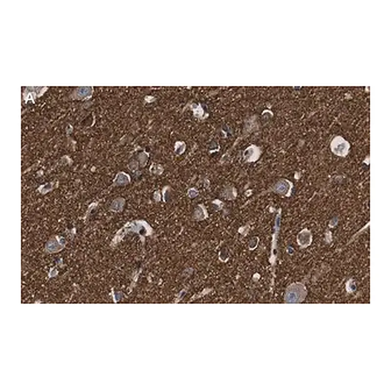 Merck Anti-α-synuclein Antibody, clone 1D22 ZooMAb Rabbit Monoclonal