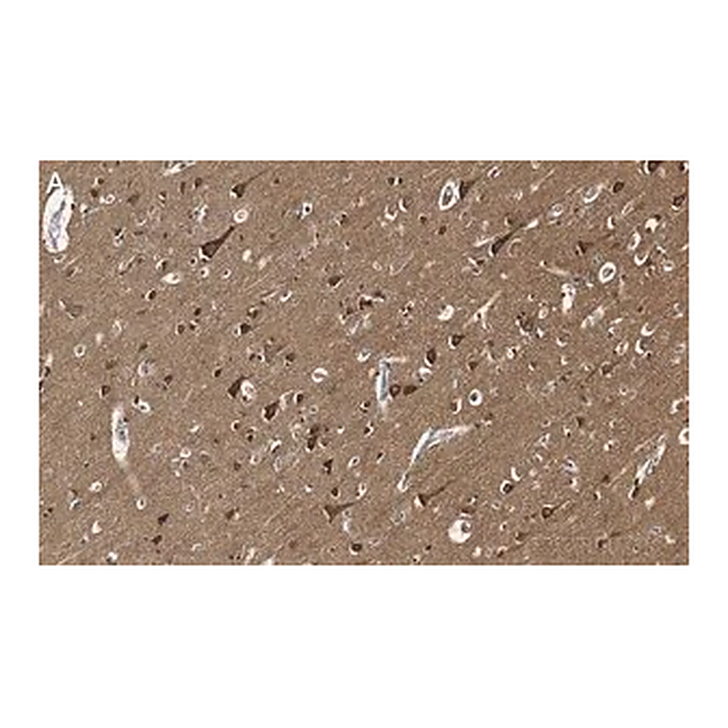 Merck Anti-Tau Antibody, clone 3D20 ZooMAb Rabbit Monoclonal