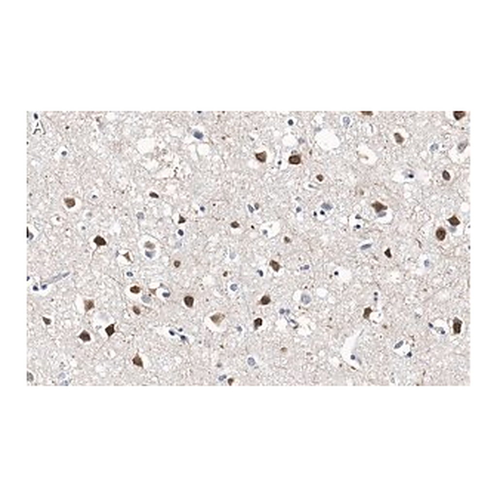 Merck Anti-SATB2 Antibody, clone 1H17 ZooMAb Rabbit Monoclonal