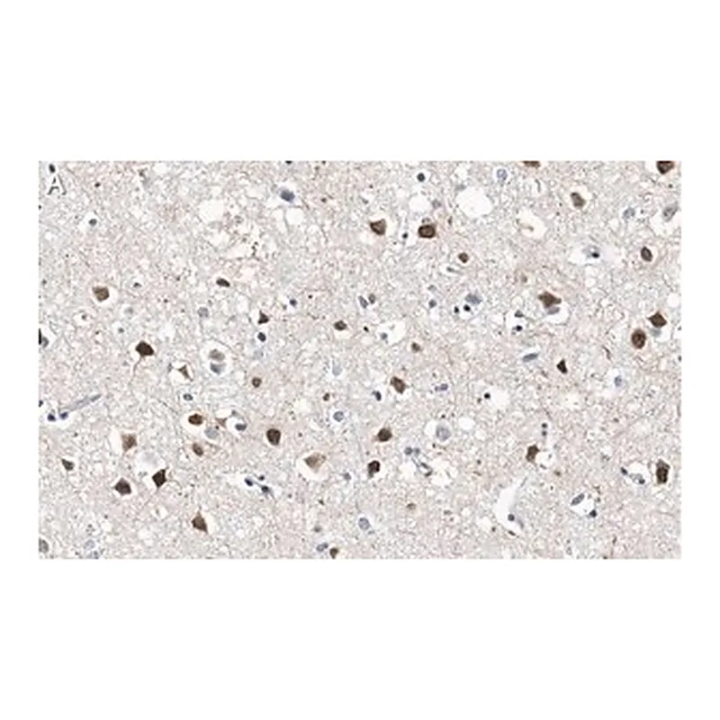 Merck Anti-SATB2 Antibody, clone 1H17 ZooMAb Rabbit Monoclonal