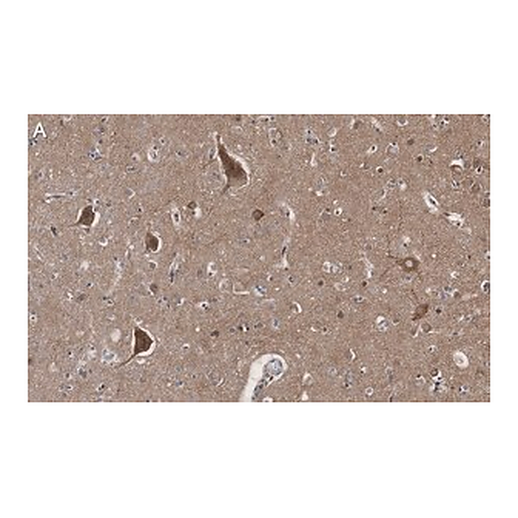 Merck Anti-BSN Antibody, clone 2I2 ZooMAb Rabbit Monoclonal