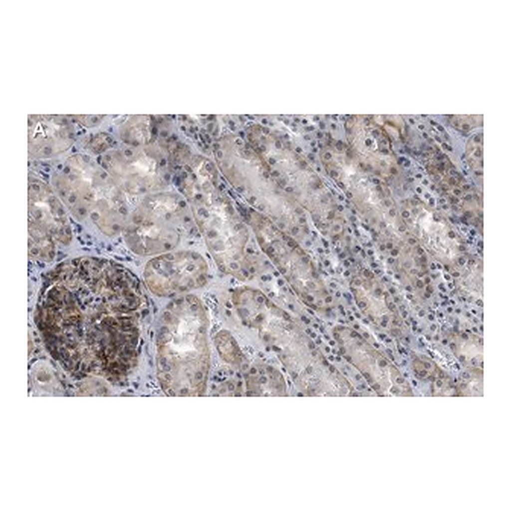 Merck Anti-NOTCH2 Antibody, clone 1B14-5 ZooMAb Rabbit Monoclonal