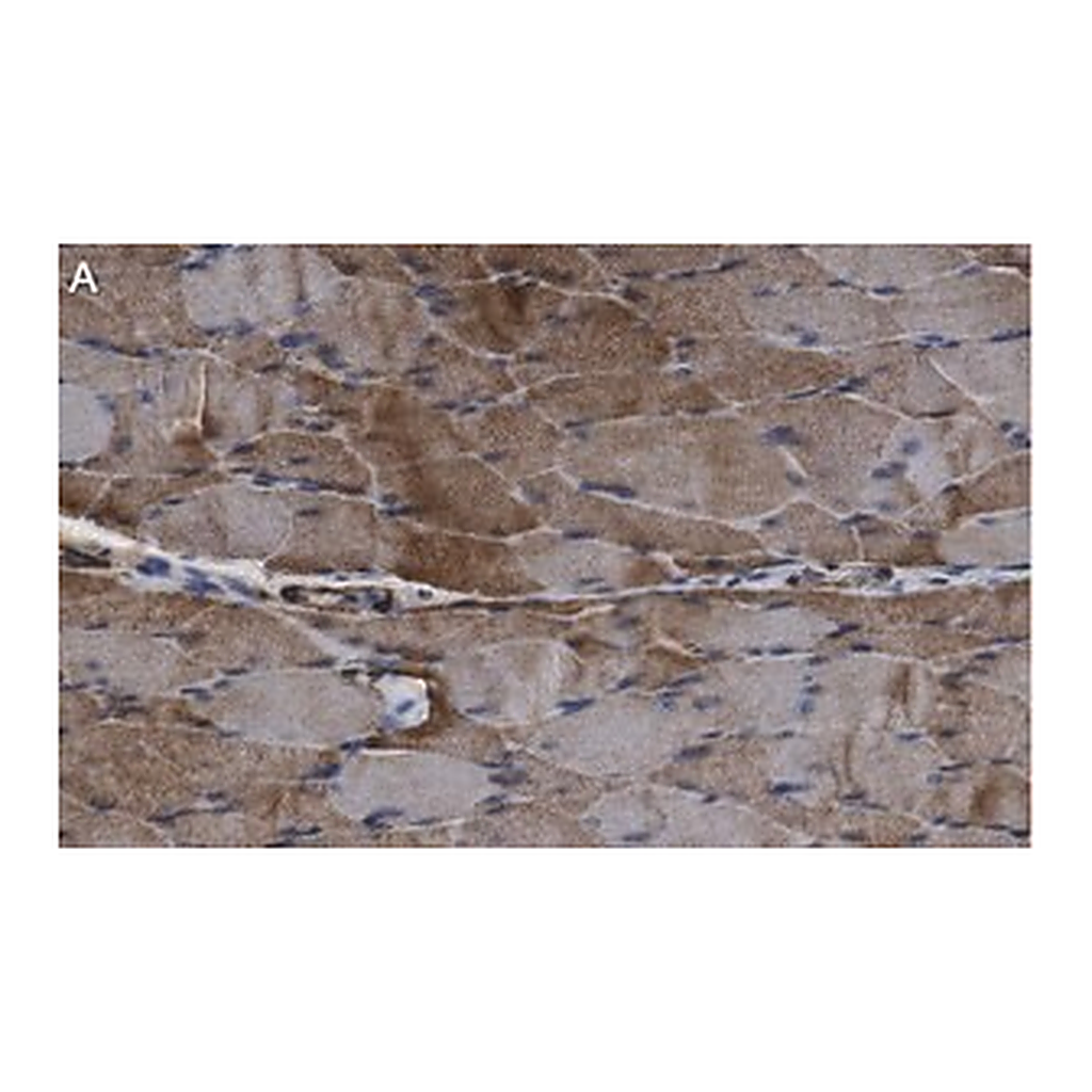 Merck Anti-ACAD10 Antibody, clone 3J20 ZooMAb Rabbit Monoclonal