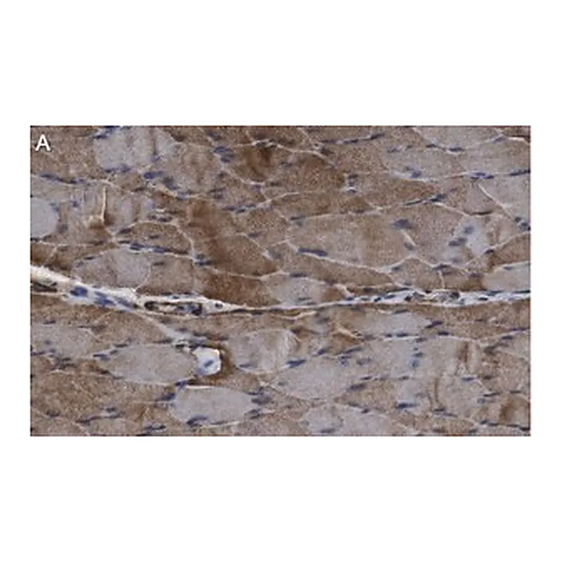 Merck Anti-ACAD10 Antibody, clone 3J20 ZooMAb Rabbit Monoclonal