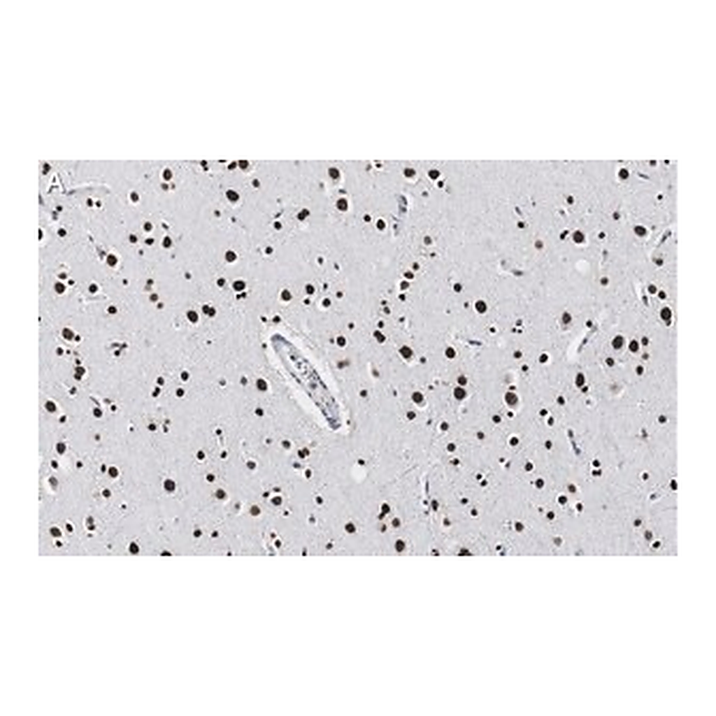 Merck Anti-Histone H2A.X Antibody, clone 1C22 ZooMAb Rabbit Monoclonal