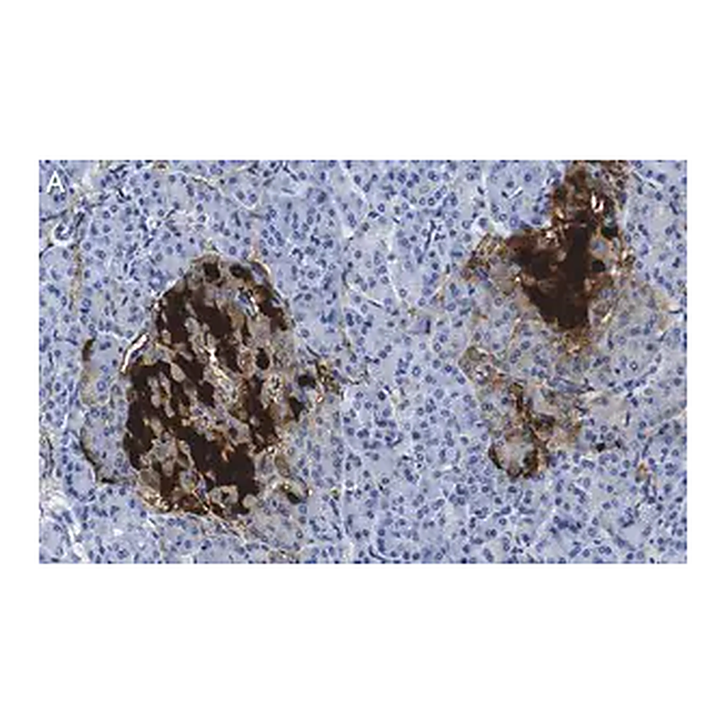 Merck Anti-PGP9.5/UCHL1 Antibody, clone 3C13 ZooMAb Rabbit Monoclonal