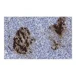 Merck Anti-PGP9.5/UCHL1 Antibody, clone 3C13 ZooMAb Rabbit Monoclonal