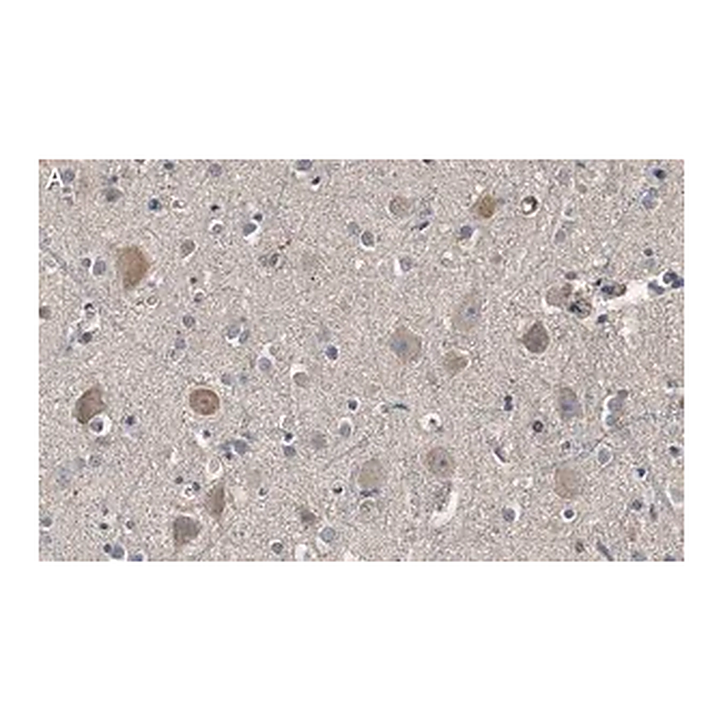 Merck Anti-Akt Antibody, PH Domain Antibody, clone SKB1 ZooMAb Mouse Monoclonal