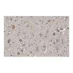 Merck Anti-Akt Antibody, PH Domain Antibody, clone SKB1 ZooMAb Mouse Monoclonal