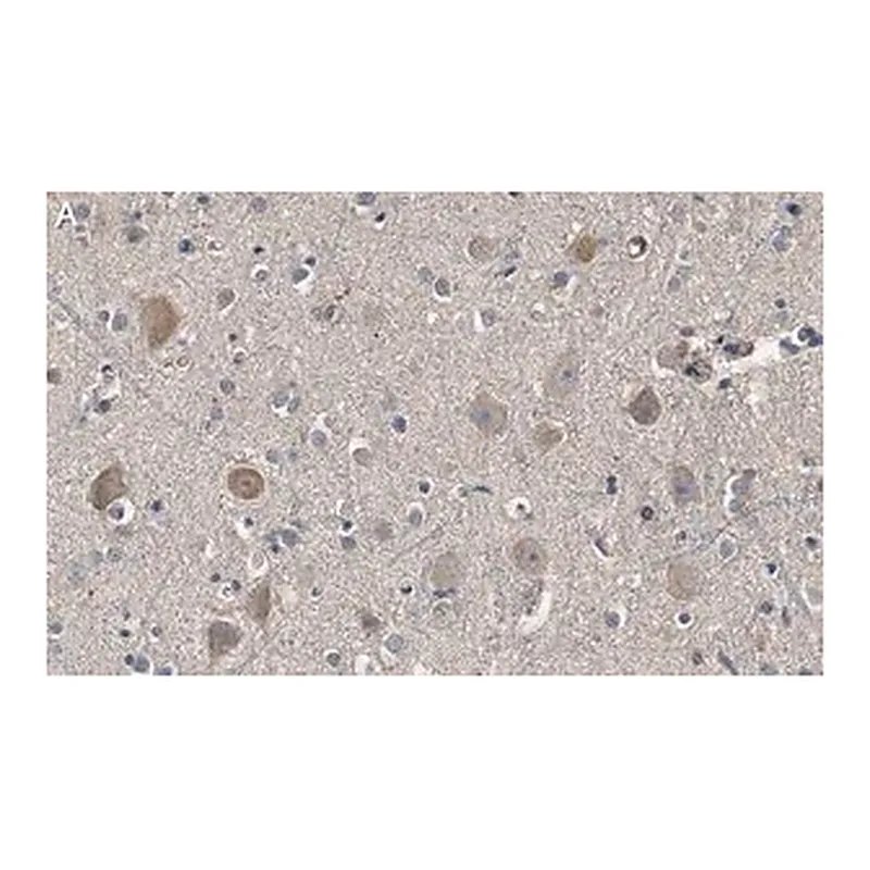 Merck Anti-Akt Antibody, PH Domain Antibody, clone SKB1 ZooMAb Mouse Monoclonal