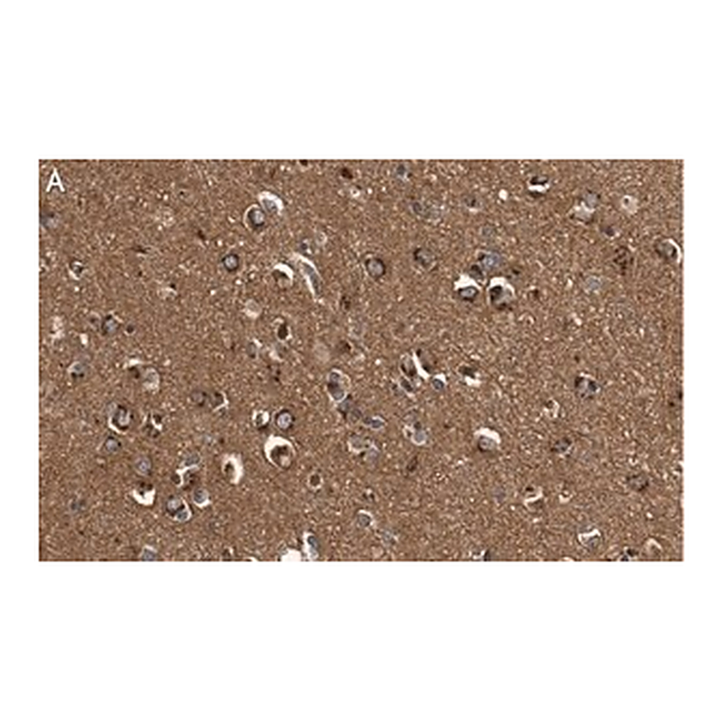 Merck Anti-DKK3 Antibody, clone 3H17 ZooMAb Rabbit Monoclonal
