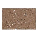 Merck Anti-DKK3 Antibody, clone 3H17 ZooMAb Rabbit Monoclonal