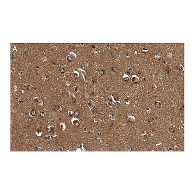 Merck Anti-DKK3 Antibody, clone 3H17 ZooMAb Rabbit Monoclonal