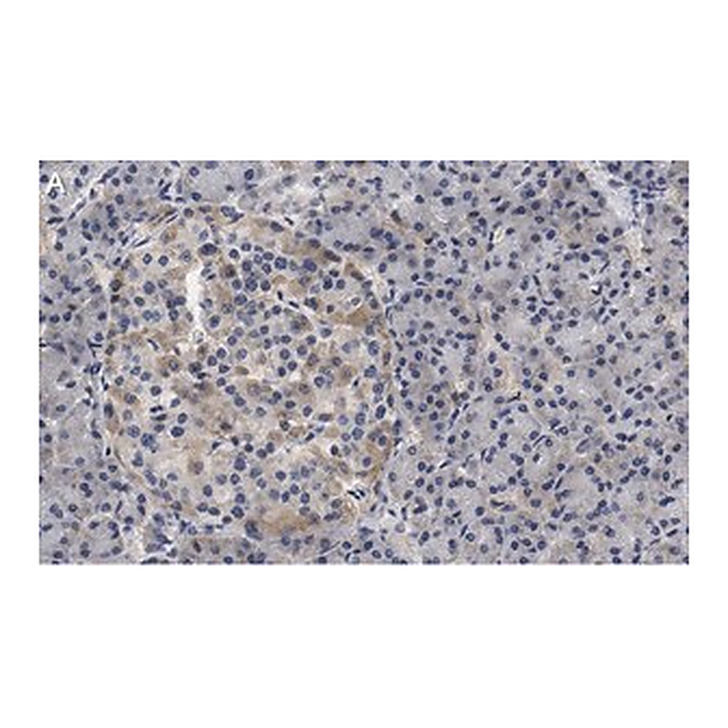 Merck Anti-Helicase MOV-10 Antibody, clone 3B8 ZooMAb Rabbit Monoclonal