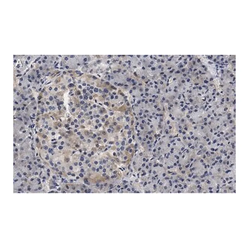 Merck Anti-Helicase MOV-10 Antibody, clone 3B8 ZooMAb Rabbit Monoclonal