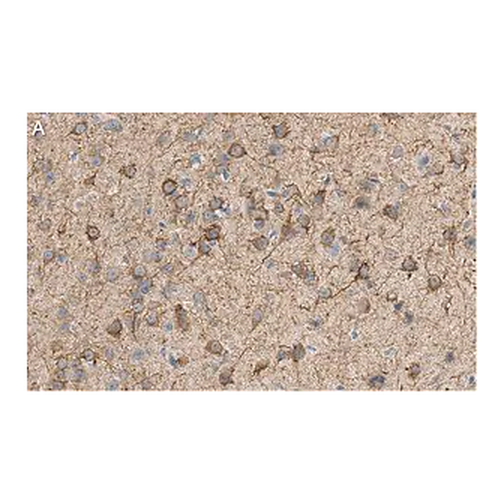 Merck Anti-MAP2 Antibody, clone AP20 ZooMAb Mouse Monoclonal