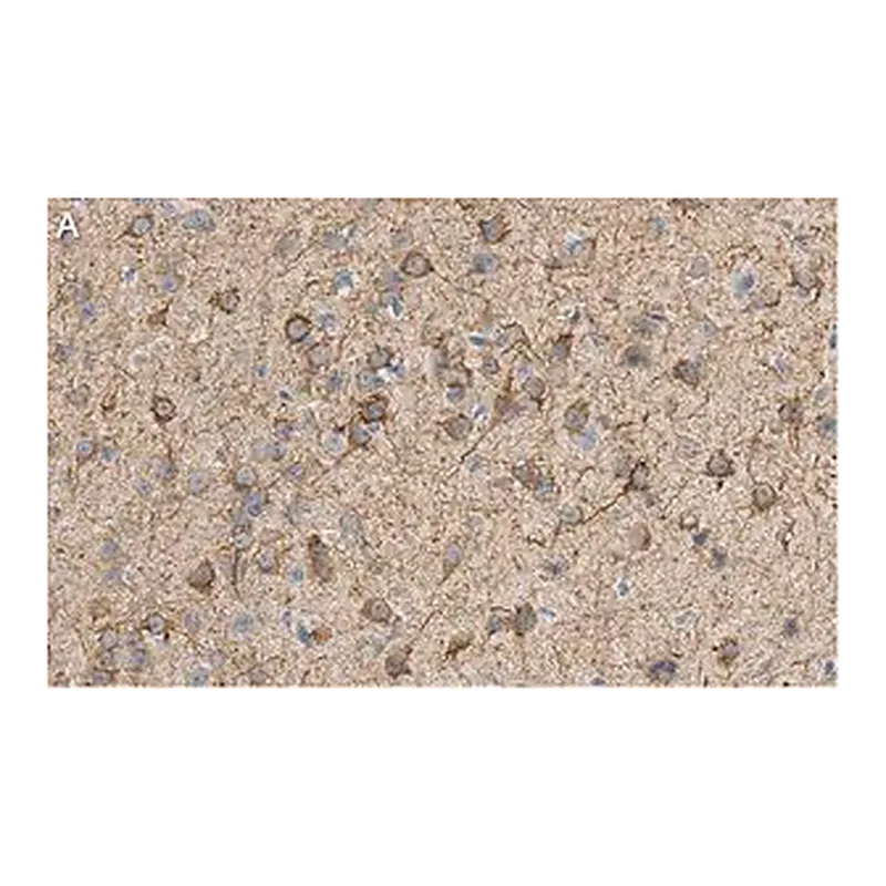 Merck Anti-MAP2 Antibody, clone AP20 ZooMAb Mouse Monoclonal