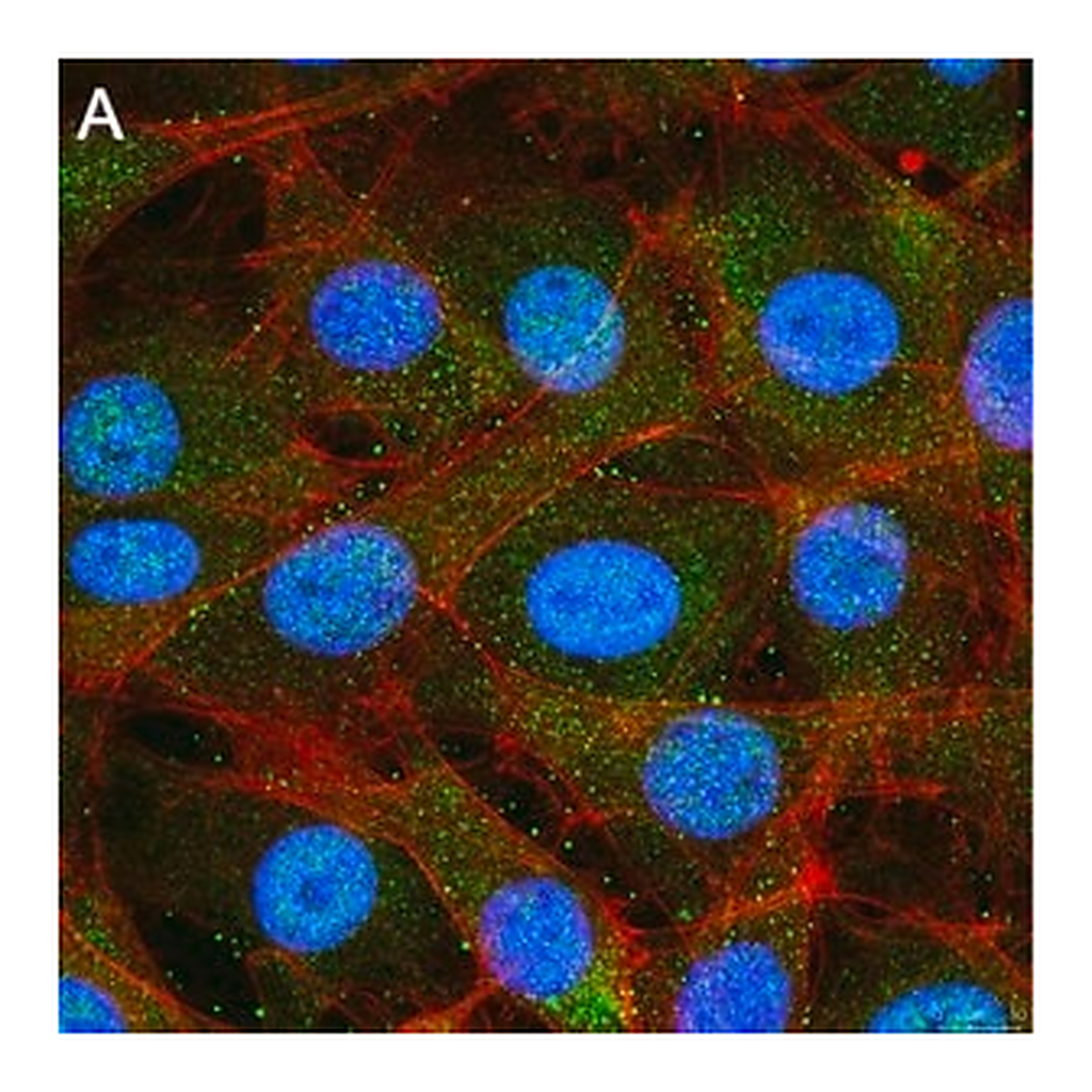 Merck Anti-Treslin Antibody, clone 5L19 ZooMAb Rabbit Monoclonal