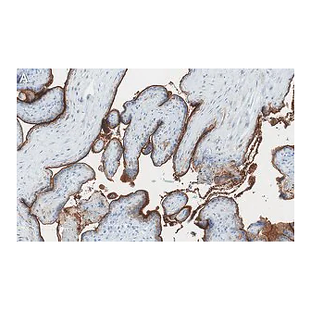 Merck Anti-Integrin β3 Antibody, clone EM00212 ZooMAb Rabbit Monoclonal