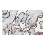 Merck Anti-Integrin β3 Antibody, clone EM00212 ZooMAb Rabbit Monoclonal