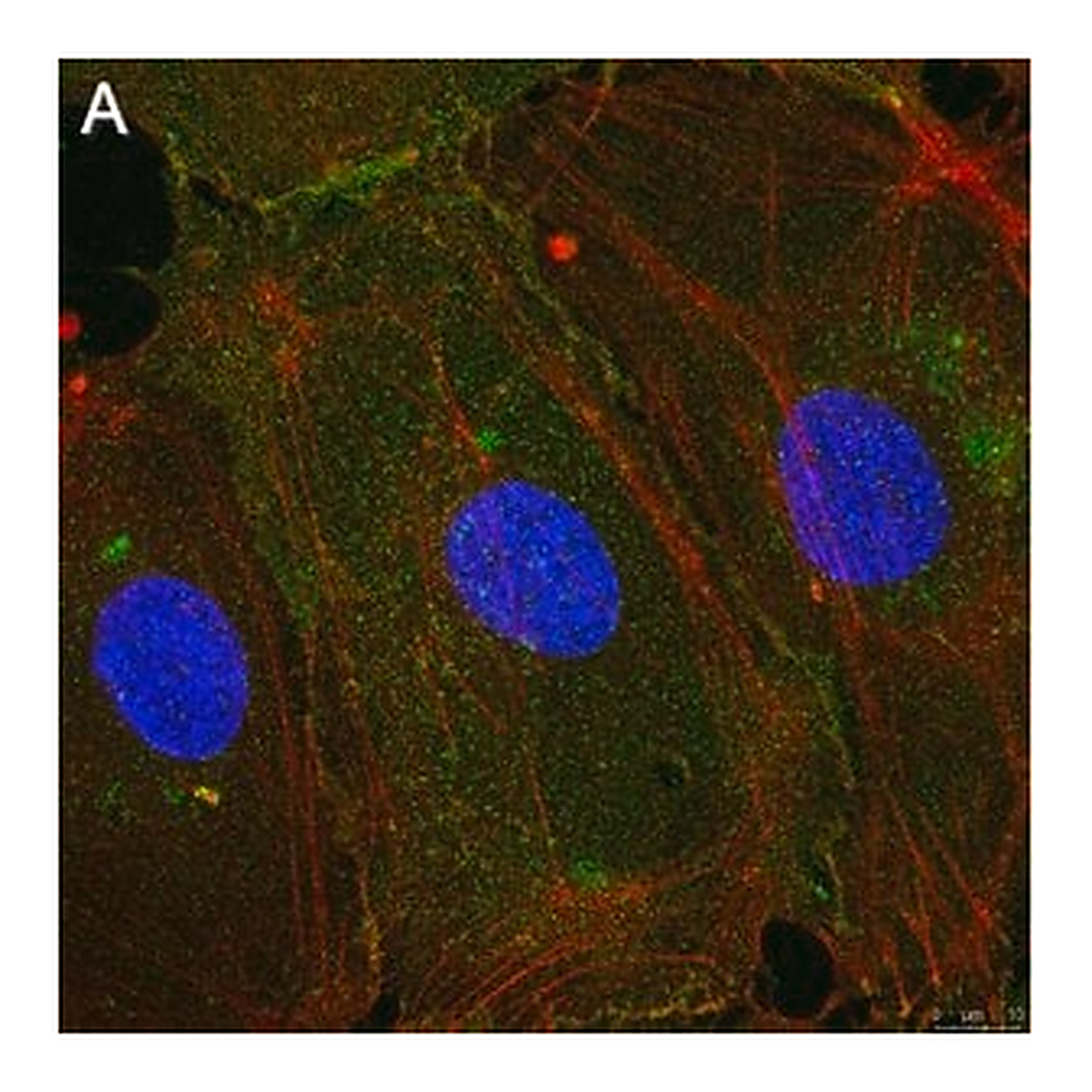 Merck Anti-Integrin αVβ3 Antibody, clone LM609 ZooMAb Mouse Monoclonal