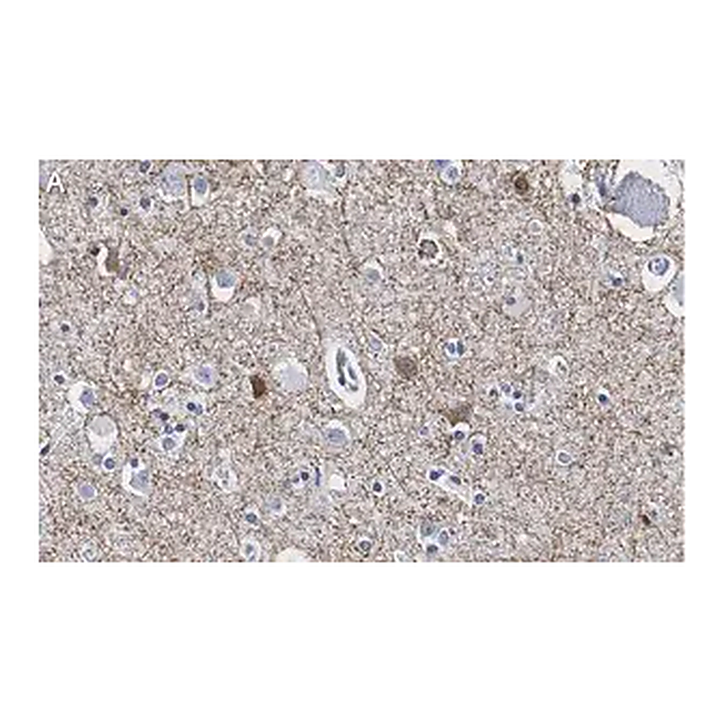Merck Anti-GAD65 Antibody, clone 3B23 ZooMAb Rabbit Monoclonal