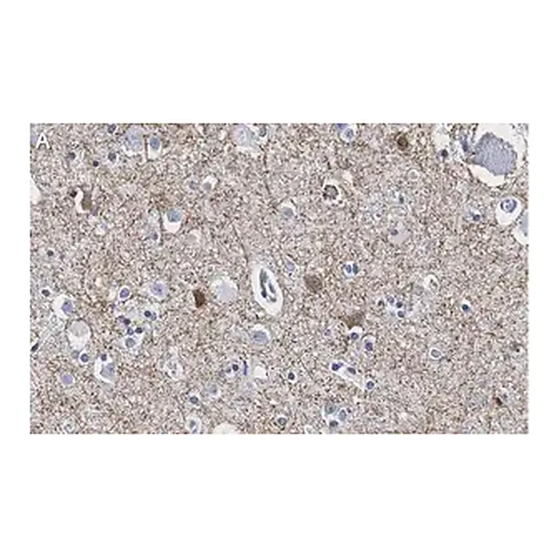 Merck Anti-GAD65 Antibody, clone 3B23 ZooMAb Rabbit Monoclonal